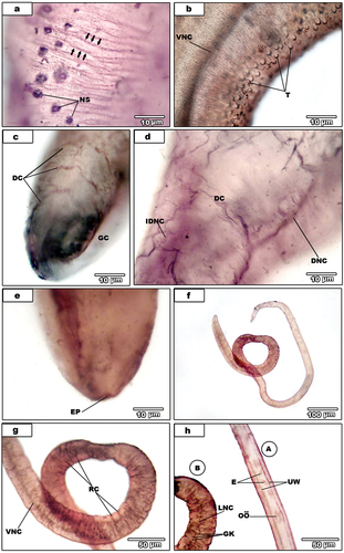 Figure 3. (A-e).Light micrographs for AgNO3-treated male S. haematobium. (a). magnification of nerve sensilla (NS). Note circular muscles nerves (black arrows). (b). dorsal surface showing tubercles (T) and ventral nerve cord (VNC). (C). male with dorsal connectives (DC) and the gynaecophoral canal (GC). (d). magnification of the posterior regionshowing dorsal connectives (DC), dorsal nerve cord (DNC) and inner dorsal nerve cord (IDNC). (e). excretory pore (EP). (f-h) light micrographs for AgNO3-treated female S. haematobium. (f). Whole female. (g). Magnification of posterior region showing ring commissures (RC) and ventral nerve cord (VNC). (3 H). magnification of anterior region (A), egg (E), ootype (OӦ) and uterus wall (UW) and the beginning of posterior region (B) showing ganglion knots (GK) and lateral nerve cord (LNC).