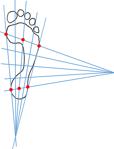 Figure 4 Rossi’s Podometric System.