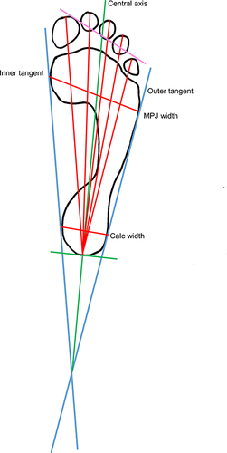 Figure 5 The Reel method.