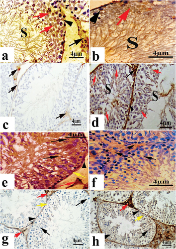 Figure 5. A photomicrograph from testicular tissue (a-d) vimentin immunoreaction; (a) control; (b) saffron group: showing strong positive expression of vimentin as a brown color; (c) khat group showing a highly significant reduction in the vimentin expression as faint brown color; (d) khat and saffron group showing vimentin expression as a moderate brown color; sertoli cells (arrowhead), spermatogenic cells (red arrows), tail of spermatozoa (S) and interstitial tissue (black arrows); (e-h) E-Cadherin immunoreaction (e): control; (f) saffron group showing strong expression of Cadherin; (g): khat group showing a marked reduction in cadherin immunoreaction; (h): khat and saffron group showing expression of cadherin as a moderate brown color; (arrowhead) membrane of the seminiferous tubules, (yellow arrow) sertoli cell, (black arrow) spermatocytes, (red arrow) interstitial tissue.