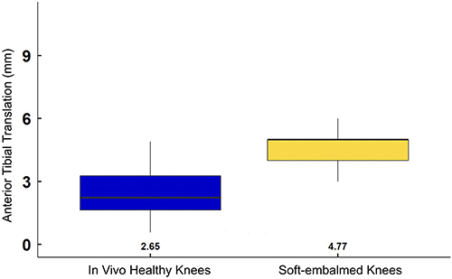 Figure 3 Anterior tibial translation of in vivo health knees versus soft-embalmed cadaver knees at 89N.