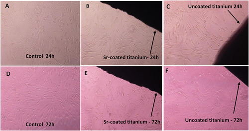 Figure 1 Morphological changes in gingival fibroblasts cultured in Sr-coated and uncoated Ti samples. The cells were examined after 24 (A-C) and 72 hours (D-F) by an inverted microscope at 100X magnification.