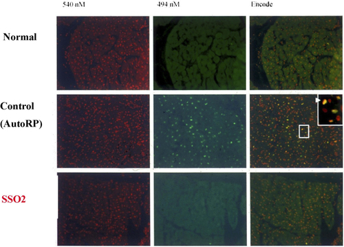 Figure 3 Representative histologic sections of porcine myocardium stained with both propidium iodide (red fluorescence of all nuclei, left column) and terminal deoxynucleotidyl transferase dUTP nick end labeling of apoptotic cells (green fluorescence; DeadEndTM Fluorometric TUNEL System, Promega)(middle column).Citation115 Superimposition of the fluorescent images in right column (Dual). Normal = myocardium not subjected to ischemia (top row). Control AutoRP = 3 hrs of reperfusion (AutoRP = passive reperfusion) after one hour ischemia (LAD occlusion)(middle row). SSO2 = 3 hrs of reperfusion after one hour ischemia (LAD occlusion), with SSO2 perfusion performed for 90 mins, 15 mins after the onset of reperfusion (bottom row). Apoptosis, in a heterogeneously distributed pattern (green dots), was noted in each Control AutoRP animal (n = 3) and in none of the animals in the Normal group (n = 3) and the SSO2 group (n = 3).