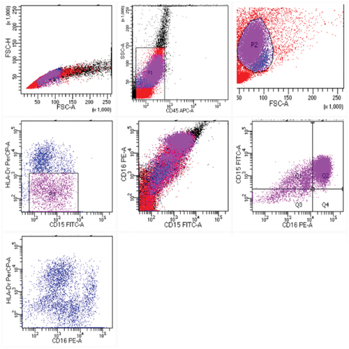 Figure 1. Flow cytometry dot plots of cell populations in the ascitic fluid. Using both side scatter and forward scatter, then gating on viable cells, we identified CD45 positive hematological cells, labeled macrophages (HLA-DR positive, CD15 positive), labeled granulocytes (HLA-DR negative, CD15 positive), and finally classified granulocytes according to CD16 into: neutrophils CD16 positive, and eosinophils CD16 negative.