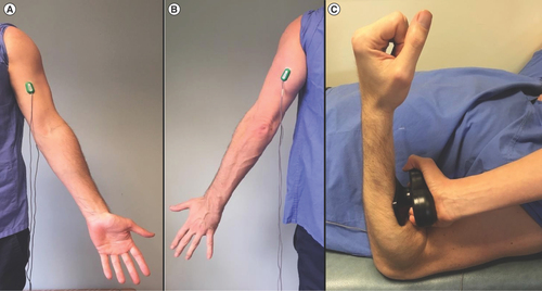 Figure 1. A visual representation of the study setup. Image (A) indicates the placement of the recording electrode over the elbow flexor compartment (biceps brachialis), (B) placement of the recording electrode over the elbow extensor compartment (triceps brachii) and (C) indicates the positioning of the handheld dynamometry (HHD) for force measurements during the sustained and repeated models of fatigue assessment.Reproduced with permission from [Citation8] © The British Editorial Society of Bone and Joint Surgery.