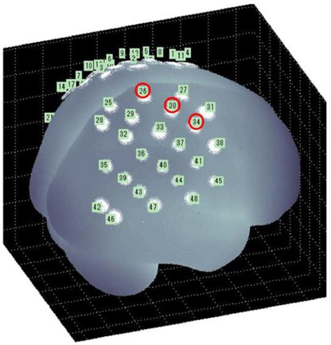 Figure 2 The channels of the right hemisphere functionally identified as motor areas (red circles).