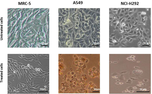 Figure 3. Morphology of lung cancer, A549 and NCI-H292, and normal lung, MRC-5, cells treated with the ethanolic Mangifera indica L. kernel extract at the IC50 concentration of 12.33, 9.55, and 63.86 μg/mL, respectively, for 24 h. A549 = human adenocarcinoma alveolar basal epithelial cell; NCI-H292 = human muco-epidermoid bronchiolar carcinoma cell; MRC-5 = normal human lung cell. Magnification: 200×.
