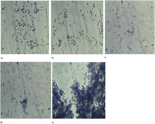 Figure 8. Morphological alteration of Porphyridium cruentum in gasoline at the end of the experiment; a) P. cruentum before experiment, b) 0% WSF, c) 25% WSF, d) 50% WSF and e) 100% WSF of kerosene, respectively. Magnification x 100, arrows highlight algal cells.