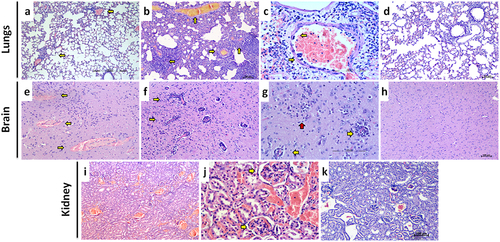 Figure 5. Histopathological observations in NiV infected hamsters after intraperitoneal infection. a) Lung section showing multifocal perivascular inflammatory cell infiltration in the alveolar parenchyma (arrows) on 3 days post infection, (H& E, scale bar = 100 µm). b) Lung section showing vasculitis, thrombosis and diffuse alveolar thickening on 7 days post infection, (H& E, scale bar = 100 µm) c) Blood vessel in the lungs showing multiple endothelial cell syncitia formation (arrows) and perivascular mononuclear cell infiltration, (H& E, scale bar = 200 µm) d) Lung section showing normal histological features, (H& E, scale bar = 200 µm) e) Brain section showing blood vessels with haemorrhage in the perivascular space, (H& E, scale bar = 200 µm). f) Brain section showing multiple blood vessels with perivascular cuffing, (H& E, scale bar = 100 µm). g) Brain section showing blood vessels with perivascular cuffing (yellow arrows) and gliosis (red arrow), (H& E, scale bar = 200 µm). h) Brain section showing normal histological features, (H& E, scale bar = 100 µm) i) Kidney section showing diffuse vascular engorgement, (H& E, scale bar = 200 µm).J) Kidney section showing congested blood vessels and thrombotic plugs in the glomerular capillaries, (H& E, scale bar = 200 µm).K) Kidney section showing normal histological features, (H& E, scale bar = 100 µm).