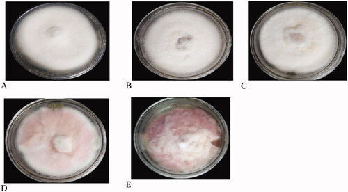 Figure 5. Colony color of some representative pictures of the culture (a) White, (b) Cottony white, (c) Creamy white, (d) Light Pink, (e) Pink.