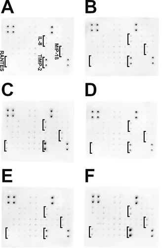 Figure 8 Protein expression in the HFFF2 cell line using a Human Inflammation Antibody Array Membrane (original drafts). (A) control (untreated); (B) F; (C) AgF; (D) AuF; (E) CuF; (F) ZnOF. The results are normalized and compared with the control groups.