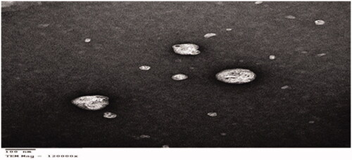 Figure 7. Transmission electron microscope image of optimum piperine-loaded bilosome.