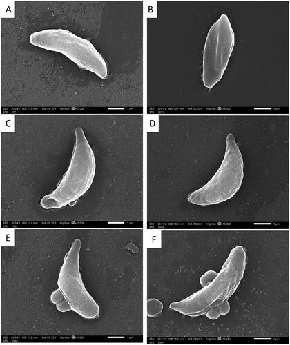 Figure 7. SEM micrographs of T. gondii tachyzoites of (A, B) group I appeared crescent-shaped with a rounded pole at one end and a pointed pole at the other with smooth regular surface (×15,000). (C, D) Group II appeared with multiple ridges and papules on their surfaces (×15,000). (E) Group III showing many papules and dimples (×15,000). (F) Group III shows multiple grooves and ridges on their surfaces (×15,000).