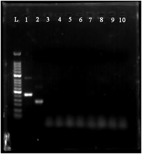 Figure 5. Cross-reactivity testing against multiple pathogens using MIRA. L: 50-bp DNA Ladder; 1: positive control (∼250 bp); 2: HAV; 3: HBV; 4: HCV; 5: HEV; 6: HIV-1; 7: HSV-1; 8: JEV; 9: rotavirus 10: human genome.