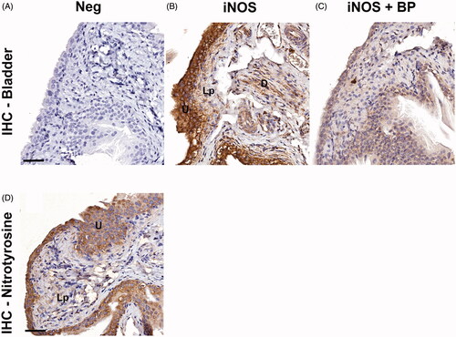 Figure 1. Representative images of the protein expression of iNOS or nitrotyrosine in normal urinary bladder in rat. (A) The bladder specimen was stained without primary antibody against iNOS (negative control; Neg), resulting in no immunoreactivity. (B) Application of the Santa Cruz anti-iNOS antibody to the rat bladder specimen demonstrated immunoreactivity in the urothelium (U) and to a lesser extent also in the lamina propria (Lp) and the detrusor muscle (D). (C) Application of the Santa Cruz anti-iNOS antibody to the bladder specimen, after incubation of the antibody with its immunogenic peptide (‘blocking peptide’) markedly attenuated the immunoreactivity. (D) Application of the anti-nitrotyrosine antibody to the bladder specimen demonstrated immunoreactivity in the urothelium (U) and leaving the lamina propria (Lp) essentially unstained. Scale bars: 50 µm.