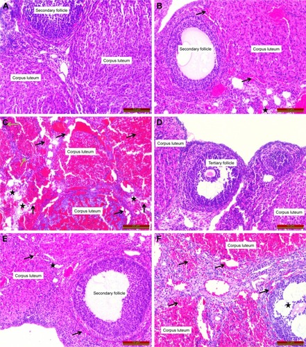 Figure 2 Histopathologic examination of the tissues (hematoxylin and eosin).