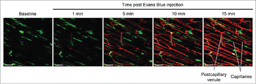 Figure 5. Evans Blue intravenous delivery using jugular vein catheter. Snapshot images of the inner muscle fiber layer from in vivo imaging during a slow intravenous delivery of Evans Blue via the jugular vein catheter into a LysM-GFP mouse. Evans Blue is slowly delivered to the mouse at time t=10 min. Snapshot images are shown at 1 min, 5 min, 10 min and 15 min after the start of Evans Blue introduction. Perivascular macrophages (green) line the blood vessels (red). Excitation: 950 nm using a Ti:Sapphire laser. Scale bar: 50 μm.