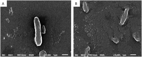 Figure 4. Scanning electron micrograph of an illustrative K. pneumoniae isolate (A) untreated cells (control): intact, normal size and rod-shaped cells with smooth surfaces and (B) treated cells with endophytic fungal extract: distorted cells with rough surfaces and deformed shape (×10,000).