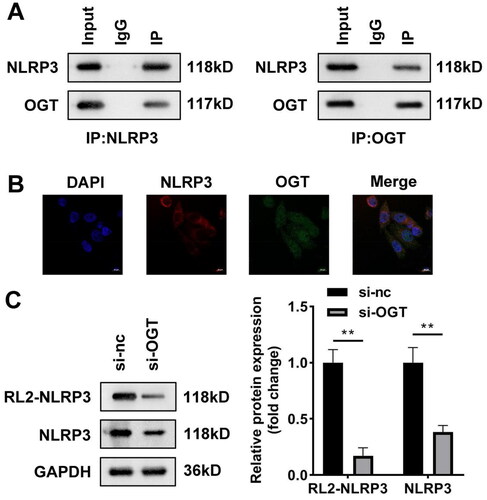 Figure 5. OGT interacts with NLRP3 in vitro. (A) Co-IP and western blot were combined to indicate binding relationship between OGT and NLRP3. (B) Immunofluorescence colocalisation in HepG2 cells revealed that OGT can colocalise with NLRP3. (C) NLRP3 protein levels in HepG2 cells after inhibition of OGT. Co-IP: Co-immunoprecipitation; OGT: O-GlcNAc transferase.