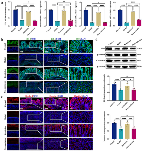 Figure 2. Anti-α4β7-integrin therapy repairs intestinal barrier damage in remission-achieving colitis mice. (a) Tight junctions mRNA expression levels (n = 6). (b and c) Immunofluorescence images displaying Zonula occludens-1 (ZO-1) and claudin-1 in situ expression. Scale bars = 100, 50, and 20 μm (n = 4). (d) Immunoblots showing ZO-1 and claudin-1 protein expression levels (n = 6). Mean ± SD is shown. One-way ANOVA was applied. nsp > .05, *p < .05, **p < .01, ***p < .001, and ****p < .0001.