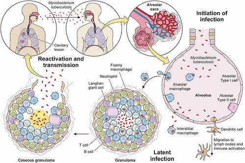 Figure 1. Overview of Mtb infection. Mtb enters the human body through the airway where it engages the innate immune system within the alveolar space. Macrophages and dendritic cells ingest the bacteria, recruiting new cells and activating adaptive immunity. Together, the innate and adaptive immune systems collaborate to eradicate the bacteria or restrict its active replication within a granuloma. Active tuberculosis occurs either after primary infection or after reactivation due to immunodeficiency, leading to symptomatic disease and transmission to a new host to start a new infection cycle.