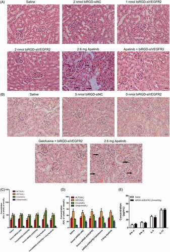 Figure 5. Toxicity and immunogenicity assessment of biRGD–siVEGFR2 in vivo. (A, B) Analysis of H&E stained sections of kidneys from in vivo anti-tumor assays. Black arrows indicate interstitial hyperemia. (C, D) Serum biochemical indicators from in vivo anti-tumor assays were used to assess potential liver and kidney toxicity. Three days after the last administration, blood serum was measured for AST, ALT, Cr and BUN in each group. (E) Analysis of IL-6, IL-12, IFN-β and IFN-α levels in the serum from C57BL/6J mice at six hours after the single injection of saline or biRGD–siVEGFR2 (2 nmol/20 g). **P<0.01, versus saline group, n = 5; bar = 20 μm.