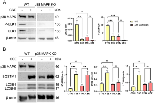 Figure 4. p38 MAPK mediates ULK1 activation and autophagosome formation in amnion epithelial cells.