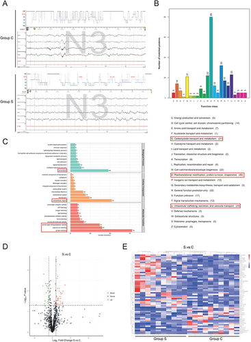 Figure 2 The sleep patterns and the label-free proteomic analysis of differentially expressed proteins of the patients in the control and S-ketamine groups. (A) Representative sleep architecture during the period of polysomnographic traces of patients in the control group (upper) and S-ketamine group (lower). (B) The major pathways involved of proteins obtained from the serum of top 10 level of SWS and the bottom 10 level of SWS patients. (C) The Gene Ontology analysis of proteins obtained from the serum of top 10 level of SWS and the bottom 10 level of SWS patients. (D) Volcano plot of differential expressed proteins in top 10 level of SWS and the bottom 10 level of SWS patients. (|fold change|>1.5 and P<0.05). (E) Hierarchical clustering analysis of differentially expressed proteins in top 10 level of SWS and the bottom 10 level of SWS patients.
