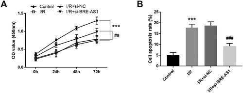 Figure 5. Effect of BRE-AS1 on (A) cell viability and (B) apoptosis in I/R cell model. ***p < .001 vs. control group, ##p < .01, ###p < .001 vs. I/R + si-NC group. The values shown are mean and standard deviation, one-way ANOVA was used. BRE-AS1: brain and reproductive organ-expressed protein (BRE) antisense RNA 1; I/R: ischemia/reperfusion.