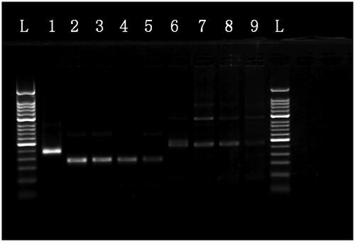 Figure 3. The MIRA products for the serial dilution of HAV plasmid DNA separated on a 2% agarose gel. L: 50-bp DNA Ladder; 1: positive control (∼250 bp); 2: 107 copies/μl template with a1 primers; 3: 106 copies/μl template with a1 primers; 4: 105 copies/μl template with a1 primers; 5: 104 copies/μl template with a1 primers; 6: 107 copies/μl template with a2 primers; 7: 106 copies/μl template with a2 primers; 8: 105 copies/μl template with a2 primers; 9: 104 copies/μl template with a2 primers.