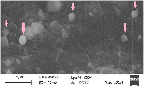 Figure 2. Scanning electron microscope image of paroxetine-loaded SLNs embedded in patch formulation.
