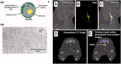 Figure 6. (i(a)). Schematic illustration of macrophage-targeted gold core nanoparticle Au-HDL. HDL = high-density lipoprotein. (i(b)) Characterization of Au-HDL on negative-stain transmission electron microscopy (TEM) image. (ii(A–C)), Spectral CT images of thorax and abdomen in apo E–KO mouse injected 24 h earlier with Au-HDL. (ii(D, E)), Spectral CT images near bifurcation of aorta in apo E–KO mouse injected with Au-HDL and an iodinated emulsion contrast agent (Fenestra VC) for vascular imaging. (Reproduced with the permission from D. P. Cormode et al. [Cormode et al., Citation2010]. Copyright 2010 Radiology).