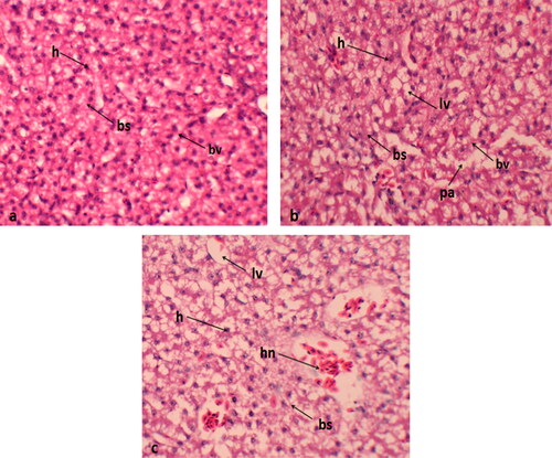 Figure 1. Histological sections of liver (a) normal histological features; (b) dilation of sinusoids and mild vacuolization of hepatocellular cytoplasm in 0.2 mg/kg group; (c) Quails received 0.4 mg/kg Se-NPs showing numerous necrotic hepatocytes, bs: blood sinusoid; h: hepatocyte; lv: lipid vacuole; bv: blood vessels; hn: hepatocyte necrosis.