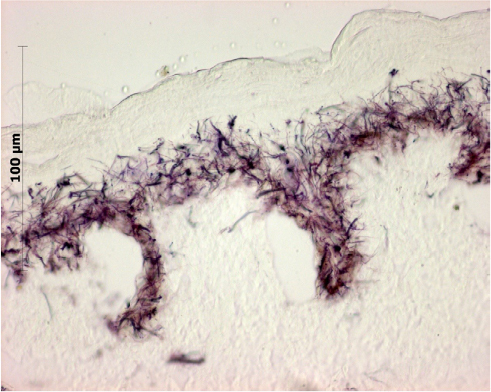 Figure 4 Histological study showing cryostat tissue sections of skin allograft samples after MTT assay: the purple formazan pigment marks viable cells and is limited to the epidermal layers.