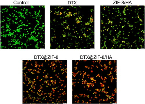 Figure 7. Dual acridine orange/ethidium bromide (AO/EB) staining shows the induction of apoptosis in the K562 cells after being treated with the IC50 concentration of DTX, ZIF-8/HA, DTX@ZIF-8 and DTX@ZIF-8/HA. Scale bar 100 µm.