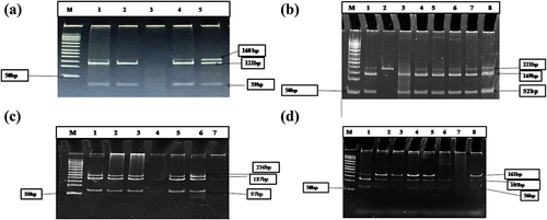 Figure 1. (a) 12% Native gel RFLP of ABCG2(rs 4693924) M-50bp Marker, 1, 4,5-mt/mt genotypes type;2,3-wt/mt genotypes; (b) ABCC2(rs2804398) M-50bp Marker 2-wt/wt genotype, 1, 3-8-mt/mt genotypes; (c) ABCC4 (rs 943288) M-50bp Marker, 1,2,3,5,6-mt/mt genotypes; 4-wt/mt; genotype;7-wt/wt genotype (d) ABCC1 (rs 9332430) M-50bp Marker, 1,2,4,5,8-mt/mt genotypes; 6-wt/mt genotype, 7-wt/wt genotype
