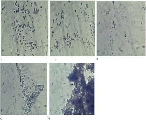 Figure 7. Morphological alteration of Porphyridium cruentum in diesel at the end of the experiment; a) P. cruentum before experiment, b) 0% WSF, c) 25% WSF, d) 50% WSF and e) 100% WSF of kerosene, respectively. Magnification x 100, arrows highlight algal cells.