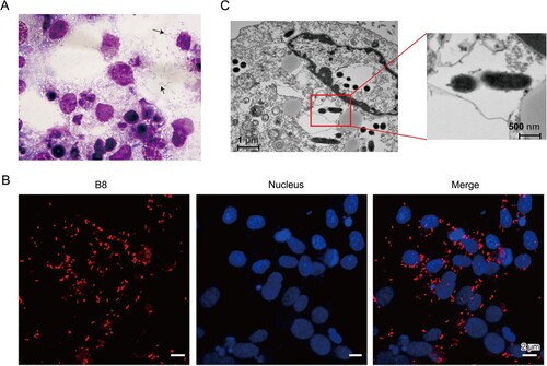 Figure 1. Morphological and biochemical characterization of Rickettsia heilongjiangensis strain B8. (A) Diff-Quick stained smears of Vero cells showed Rickettsia-like bacilli in the cytoplasm. The black arrow points to an individual bacterium. (B) Immunofluorescence microscopy of B8-infected Vero cells. DAPI (blue) was used to stain host cell nucleus; polyclonal anti-ompB antibody followed by Cy3 conjugated secondary antibody (red) was used to stain B8. (C) Scanning electron microscope (SEM) micrograph showing numerous Rickettsia-like organisms parasitizing in the cytoplasm of infected Vero cells.
