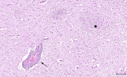 Figure 1. Histology slide stained with Hematoxylin and Eosin (H&E) showing prominent perivascular cuffing (arrow) with lymphocytes, few plasma cells and some macrophages and formation of multiple glial nodules (star). Quadrigeminal bodies, mesencephalon. Scale bar: 100 µm.