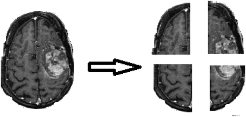 Figure 7. Real brain MR image and its blocks.
