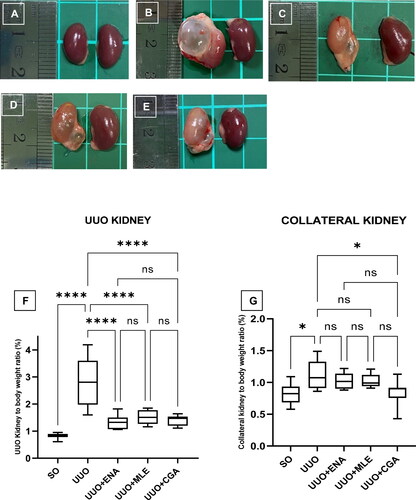 Figure 4. Gross anatomy of mice kidneys treated with enalapril, Morus alba leaves extract, and chlorogenic acid for 14 days in the UUO mice. (A) Sham operation (negative control), (B) UUO (positive control), (C) UUO treated with enalapril, (D) UUO treated with Morus alba leaves extract, (E) UUO treated with chlorogenic acid, (F) UUO Kidney to body weight ratio in Morus alba and chlorogenic acid treatment in the mice. (A,B) Collateral unobstructed kidney to body weight ratio in Morus alba and chlorogenic acid treatment in the mice. SO: sham operation; UUO: unilateral urethral obstruction; ENA: enalapril; MLE: Morus alba leaves extract; CGA: chlorogenic acid; Significance: ns: not significant; *p < 0.05; ****p < 0.0001.
