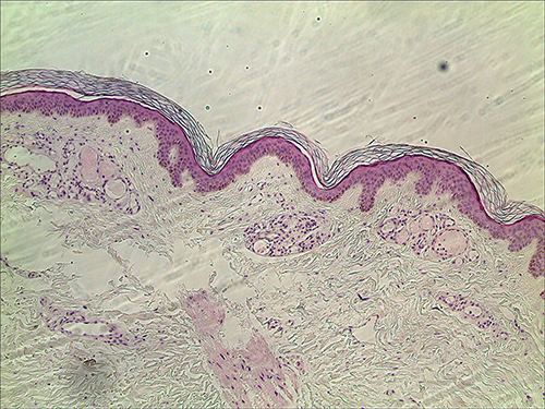 Figure 3 Dermatopathological tissue under 40*10x lens.