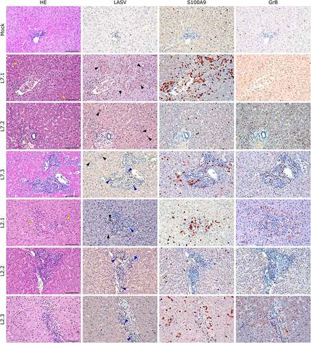 Figure 7. Comparative histopathology of the liver after challenge with L7 or L2 LASV strains. HE: hematoxylin-eosin coloration. Yellow arrowheads show signs of hepatic steatosis. LASV: immunostaining of LASV glycoprotein-2c. Black arrowheads show infected hepatocytes and interstitial cells, blue arrowheads show infected immune infiltrating cells. S100A9: immunostaining of neutrophils. GrB: immunostaining of cytotoxic cells. Scale bar: 100 µm.