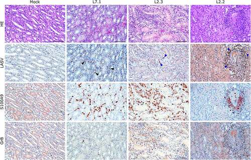 Figure 8. Comparative histopathology of the kidney after challenge with L7 or L2 LASV strains. HE: hematoxylin-eosin coloration. LASV: immunostaining of LASV glycoprotein-2c. Black arrowheads show infected endothelial cells, blue arrowheads show infected immune infiltrating cells. S100A9: immunostaining of neutrophils. GrB: immunostaining of cytotoxic cells. Scale bar: 100 µm.