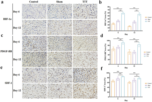 Figure 10 Elevated activity of HIF-1α, PDGF-BB, SDF-1, and VEGF in diabetic wound after TTT. (a) Representative immunohistochemistry images of HIF-1α expression in the three groups at day 6 and 12, respectively. (b) Quantitative analysis showed higher expression of HIF-1α+ in the TTT group than the other groups. (c) Representative immunohistochemistry images of PDGF-BB expression in the three groups at day 6 and 12, respectively. (d) Quantitative analysis displayed higher expression of PDGF-BB in the TTT group than that of the other groups. (e) Representative immunohistochemistry images of SDF-1 expression in the three groups at day 6 and 12, respectively. (f) Quantitative analysis demonstrated higher expression of SDF-1 expression in the TTT group than the other groups. Scale bar 100 μm, 100 × magnification. Data were presented as means (standard deviations), **p < 0.01, ***p < 0.001. TTT vs Control or Sham, Tukey’s multiple comparison test.