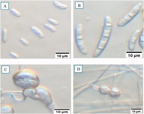 Figure 8. Microscopic characteristics of FOC isolates. (a) Oval to kidney-shaped microconidia, (b) Slightly curved, thick-walled, and septated macroconidia, (c) Intercalary chlamydospore, (d) Paired terminal chlamydospore.