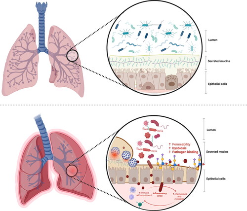 Figure 4. The microbiome-mucin axis in the respiratory tract: mucin damage matters.Upper panel: The mutualistic relationship between the airway mucins and the microbiota and derived metabolites under eubiosis. On the one hand, the microbiota and their metabolism induce the synthesis of large gel-forming mucins, including encapsulation, glycosylation, changes in fucosylation and sialidation patterns, and thickness. On the other hand, the mucin layer serves as an environmental niche and a food source for the microbiota. The high diversity of gut mucins impacts the gut microbiota composition, diversity, and stability but also influences immune homeostasis.Bottom panel: The mutualistic relationship between the mucin glycome and the microbiota under a disrupted airway ecosystem and environment. The deterioration of the respiratory mucosal barrier enables virus binding to the cells and the translocation of bacteria and lipopolysaccharides outside the respiratory tract, triggering immune and inflammatory responses, often resulting in increased permeability and, eventually, endotoxemia. Changes in the respiratory barrier integrity involve changes in the abundance, expression, and glycosylation of mucins, and thus immune dysregulation, dysbiosis, and risk of disease onset.This figure has been created with BioRender.com.