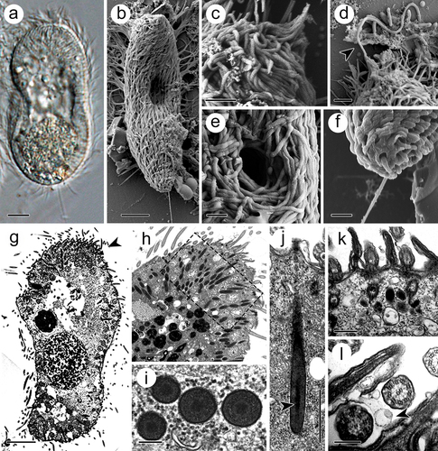 Figure 1. Theront of I. multifiliis. (a, b) Holistic view of the theront. (c, d) Magnified perforatorium at the apex. Arrowhead indicates the extrusive contents. (e) Cytostome. (f) Caudal cilium at the terminal end. (g) Longitudinal section views of theront. Arrowhead indicates the anterior part. (h) Cytoplasm of the anterior part of theront. (i) Cross section of toxicyst. (j) Longitudinal view of toxicyst showing the tube-like core (arrowhead) located within the capsule and a fibro-granular layer at the posterior end. (k) Cortex of theront. (l) Extrusion of vacuole from cilia membrane. Arrowhead indicates the ejected vacuole. Scale bars 5 μm (a, b, g), 2 μm (c, d, h), 1 μm (e, f, j), 500 nm (k), 200 nm (i, l).