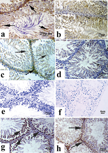 Figure 4. A photomicrograph to testicular tissue a-d) Bcl2 expression; (a) control; (b) Saffron group showing cytoplasmic Bcl2 expression in the spermatogenic cells as a brown color; (c) khat group showing Bcl2 expression in few spermatogenic cells; (d) Khat and saffron group showing Bcl2 expression in the moderate number of spermatogenic cells; (e-h) Bax expression (e): control; (f) Saffron group showing negative expression of Bax in the nuclei of spermatogenic cells, sperm and interstitial cells; (g): Khat group showing nuclear Bax expression in a large number of spermatogenic cells; (h): Khat and saffron group showing expression of nuclear Bax in moderate number of the spermatogenic cells (Bcl2 & BAX immunostain).