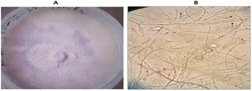 Plate 3. (a) 9-day culture of Fusarium oxysporum on PDA. (b) Microscopy of Fusarium oxysporum f. sp. cepae showing branched, hyaline and septate mycelium, macroconidia (red arrow) and microconidia (black arrow).